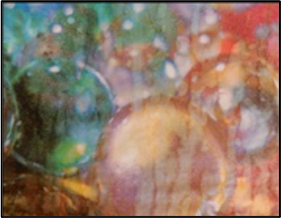 ¿Qué es la transacuatipia?